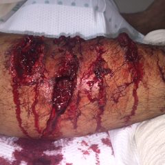 K-9 Police Dog Bite 5 Creative Commons images