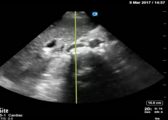 Using Bedside Ultrasound to Rapidly Differentiate Shock 10 Creative Commons images