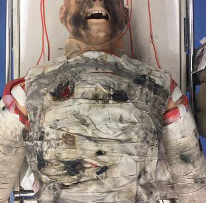 A Low Cost Escharotomy Simulation Model for Residency Education 6 Creative Commons images