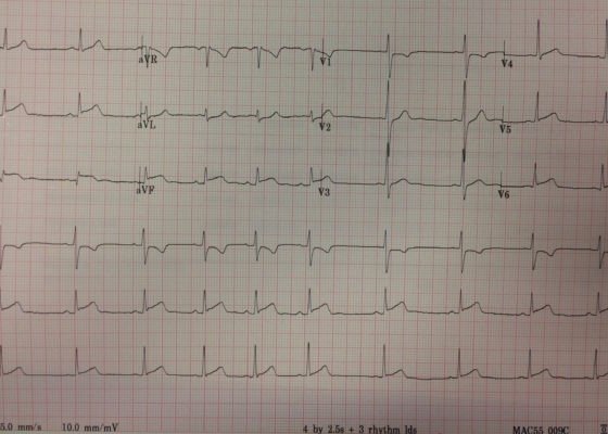 Clinical Evaluation and Management of Pediatric Pericarditis 8 Creative Commons images