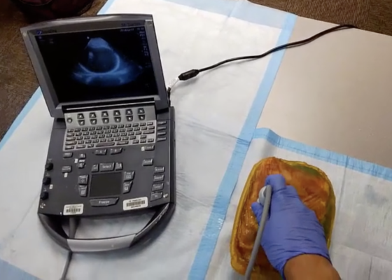A Low-Cost, Reusable Ultrasound Pericardiocentesis Simulation Model 2 Creative Commons images