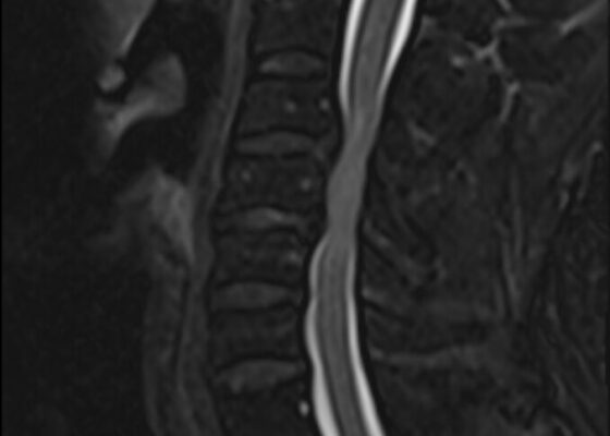 A Case Report of a Man with Burning Arm and Leg Weakness 4 Creative Commons images